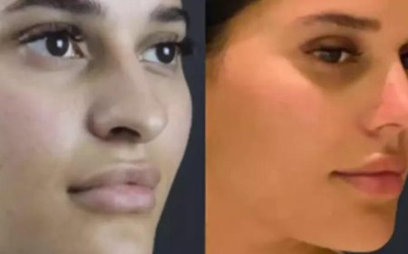 The Future of Nose Surgery in Dubai: 3D Imaging & Precision