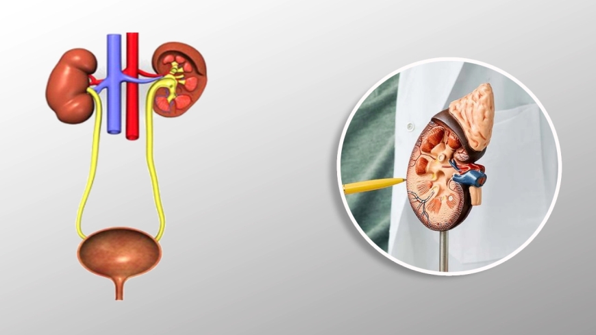 Get Relief from Enlarged Prostate: Consult an Expert Urologist in Jaipur
