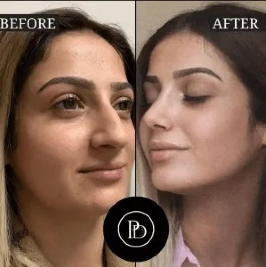 Platelet-Rich Plasma Treatment Dubai: The Full Experience