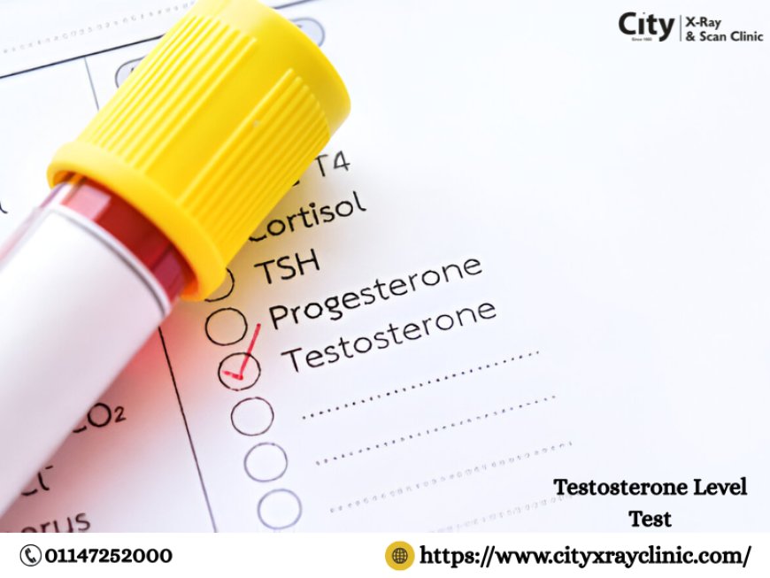 Understanding Testosterone Tests: What You Need to Know About Cost and Convenience